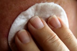 Prevenzione, tornano gli Open Day sulla dermatite atopica