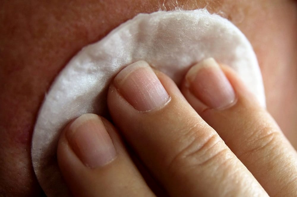 Prevenzione, tornano gli Open Day sulla dermatite atopica