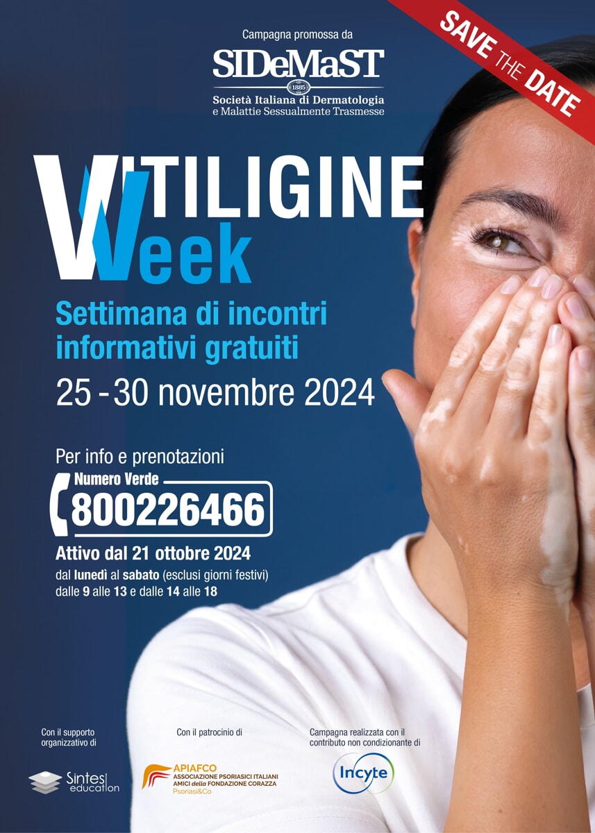 Salute, la Vitiligine Week arriva in Toscana: incontri gratis con i dermatologi